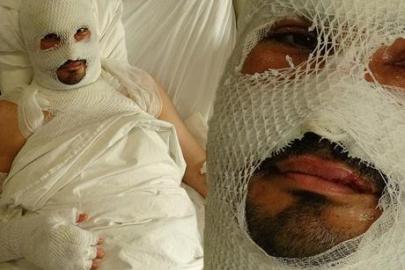 Hatay’da dehşet! Mumyaya döndü: Başımızın üstündeki lamba ve yerdeki telefon patladı